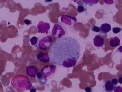 293FT（人胚肾细胞）