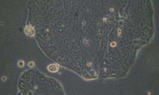 BC3H1（小鼠脑瘤细胞）