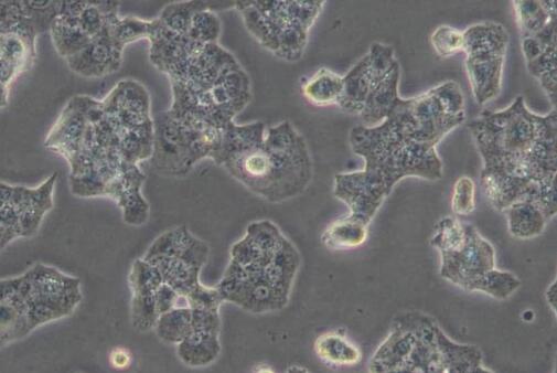 Beta-TC-6（小鼠胰岛素瘤胰岛β细胞）