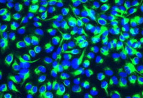 BNL 1ME A.7R.1（小鼠肝上皮细胞）