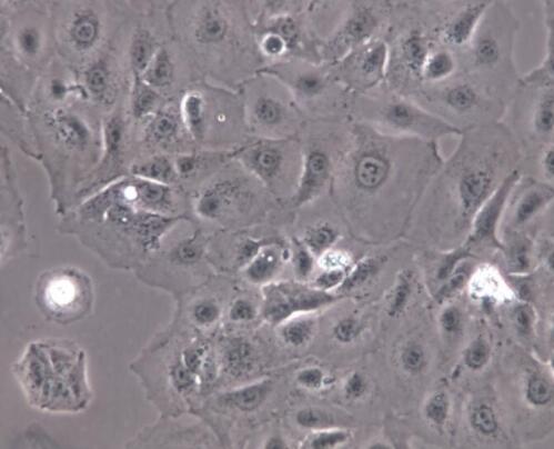 Caki-2（人肾透明细胞癌细胞）