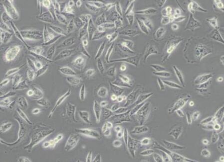 Calu-6（人退行性癌细胞）