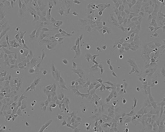 Detroit 562（人咽头癌胸水转移细胞）