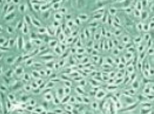 E.G7-OVA（小鼠T淋巴瘤细胞）