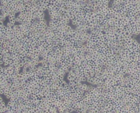 FO（小鼠骨髓瘤细胞）