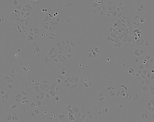 G-401（人肾癌Wilms细胞）