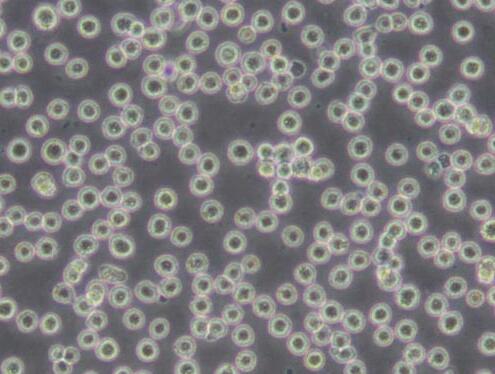 H22（小鼠肝癌细胞）