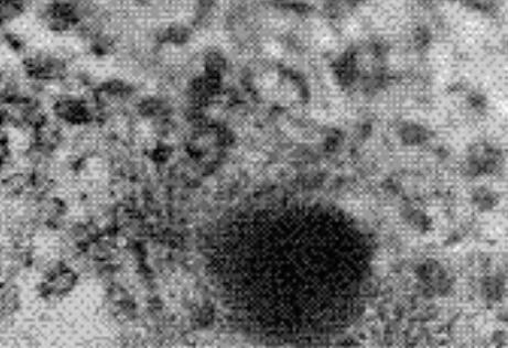 HA（人羊膜细胞）