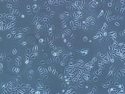 HFSF（人胚胎眼巩膜成纤维细胞）