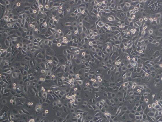 HOS（人骨肉瘤细胞）