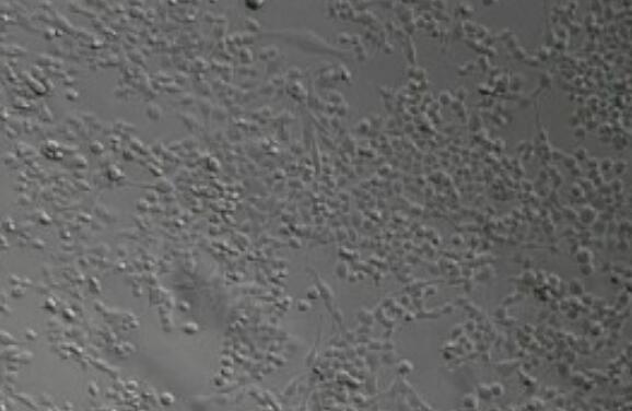 IM-9（人外周血B淋巴细胞）