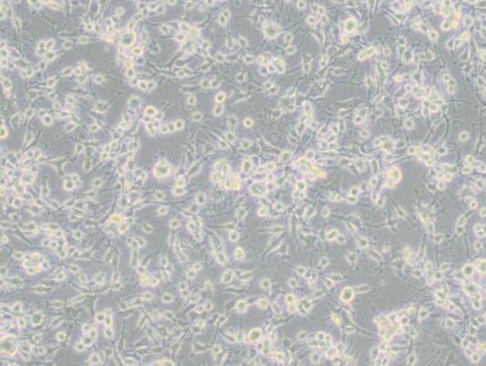 MDA-MB-436 (人乳腺癌细胞)（L15）