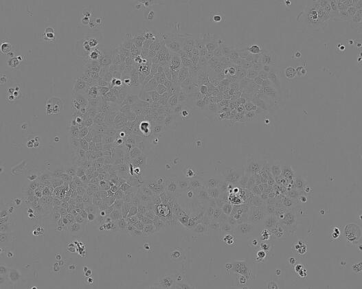 NCI-H2087 [H2087]（人非小细胞肺腺癌细胞）