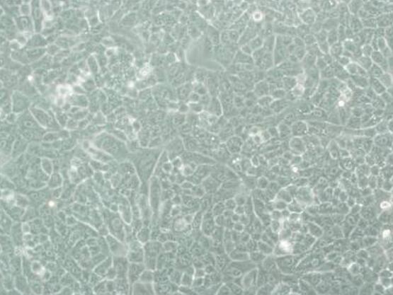 NCI-H209 [H209]（人小细胞肺癌细胞）