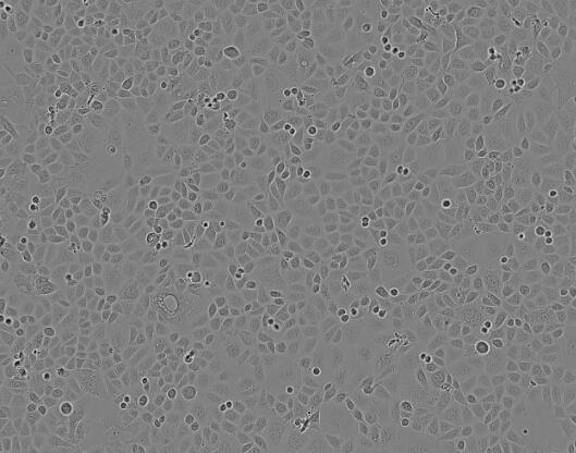 NCI-H2170（人肺鳞癌细胞）