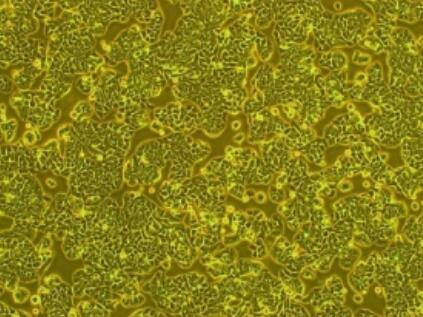 NCI-H2227（人小细胞肺癌细胞）