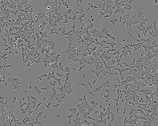 NCI-H295R（人肾上腺皮质腺癌细胞）