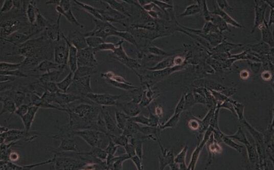 NCI-H446 [H446]（人小细胞肺癌细胞）