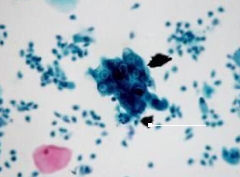 NEC（人食管癌细胞）