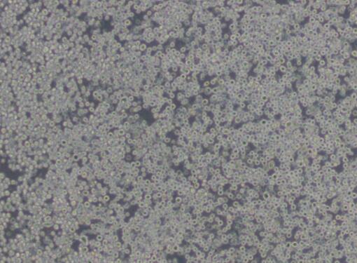 P3/NSI/1-Ag4-1 [NS-1]（小鼠骨髓瘤细胞）