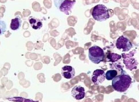 PC-3M IE8（人前列腺癌高转移细胞株）