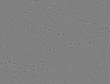 RAG（小鼠肾腺癌细胞）