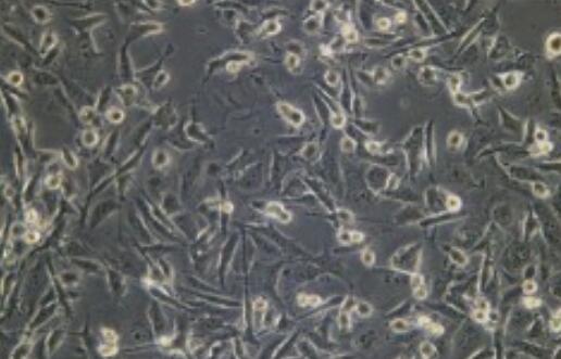 RBL-1（大鼠嗜碱性粒细胞性白血病细胞）