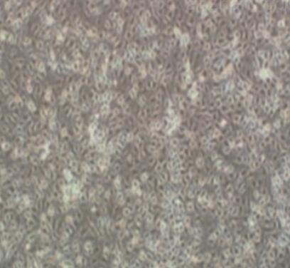 Sp2/0-Ag14（小鼠骨髓瘤细胞）