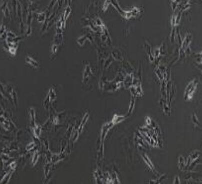 SW 982 [SW-982, SW982] (人滑膜肉瘤细胞) （L15）