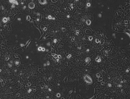 TE-10（人食管癌细胞）