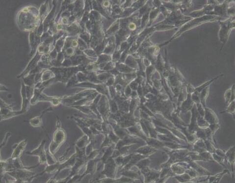 TT（人甲状腺导管癌细胞）