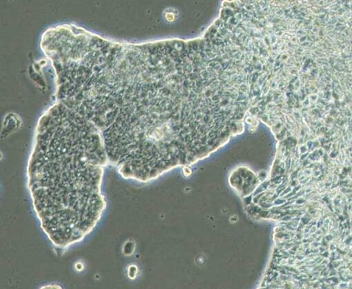 UACC-812（人乳腺导管瘤细胞）