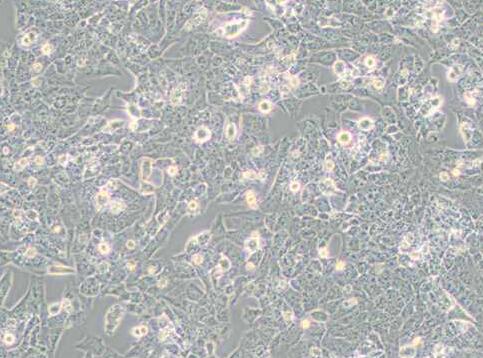 UMR-106（大鼠骨肉瘤细胞）