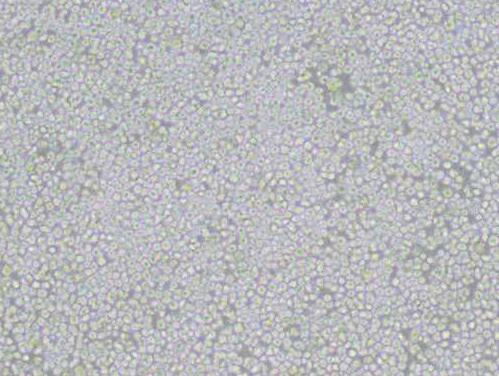 AE-1（小鼠杂交瘤细胞(抗AChE)）