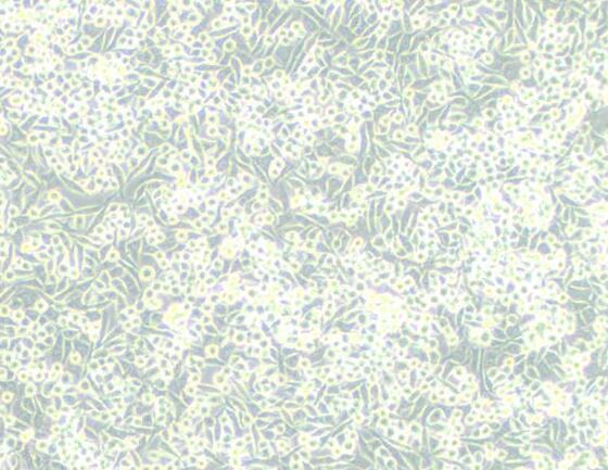 A-204 [A204]（人横纹肌肉瘤细胞）