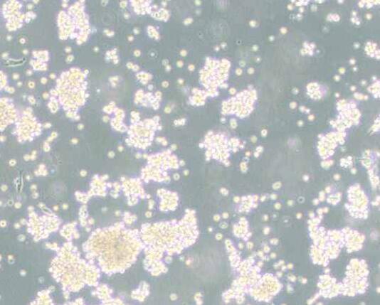 B95-8（绒猴EB病毒转化的白细胞）