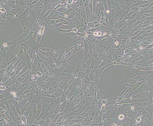 PED（猪内皮细胞）