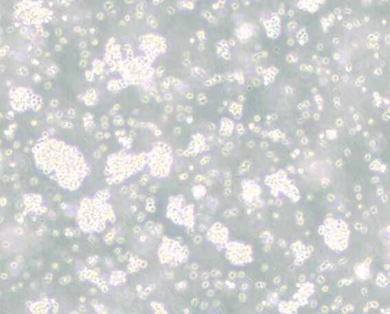 Reh（人急性非B非T淋巴细胞白血病）