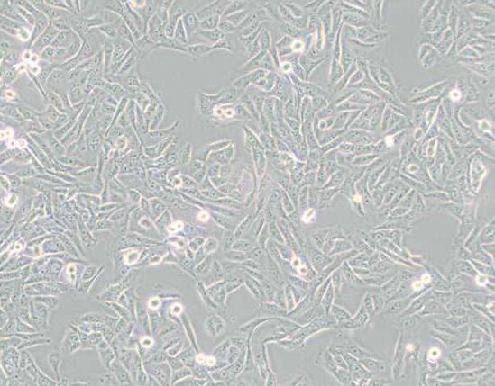 MNNG/HOS Cl #5 [R-1059-D]（人骨肉瘤细胞）