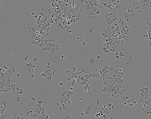 Hs 578Bst（人正常乳腺细胞）