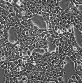 MHCC97-L（人低转移肝癌细胞）