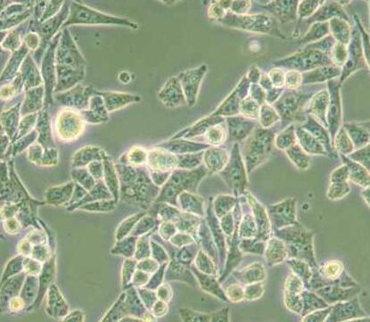 AN3 CA（人子宫内膜腺癌细胞）