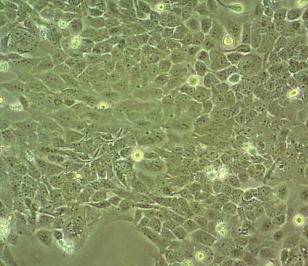 Tb 1 Lu（蝙蝠肺细胞）