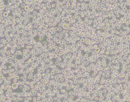 U266（人多发性骨髓瘤细胞）