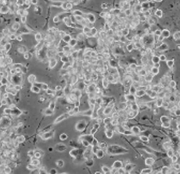 M2-10B4（小鼠骨髓纤维原细胞）