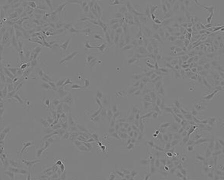 SW48（人结肠腺癌细胞）