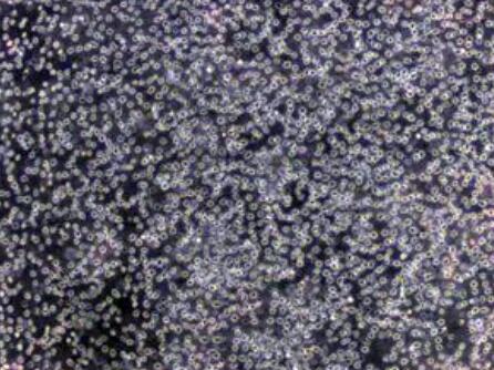 MC/CAR（人外周血淋巴细胞）