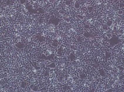 MCF-7/ADM（人乳腺癌阿奇霉素耐药性细胞）