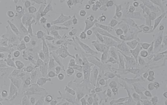 SGC-7901-GFP (人胃腺癌细胞(绿色荧光))