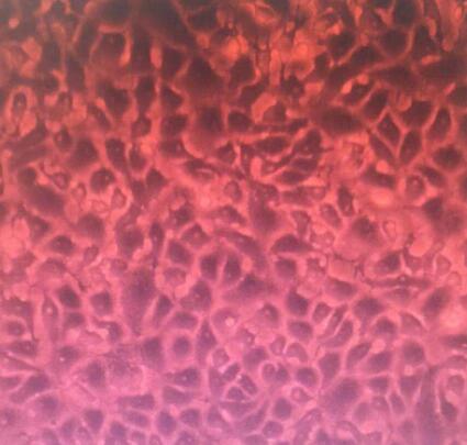 4179（长尾绿猴胚胎细胞）